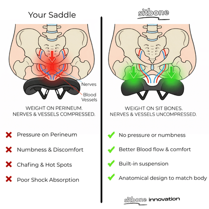 SitBone - The Pain - Free Saddle - Branwell & Co